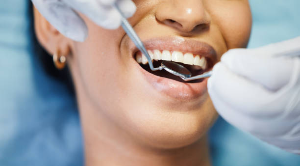 Best Emergency Wisdom Teeth Removal in Jonesville, MI